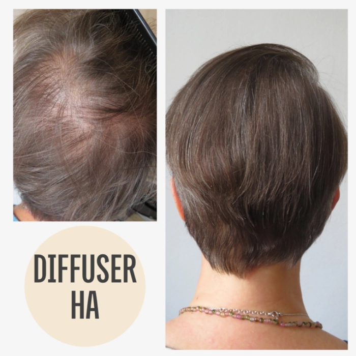 Vorher Nachher Haarausfall mit KAYA VEDA Ayurveda